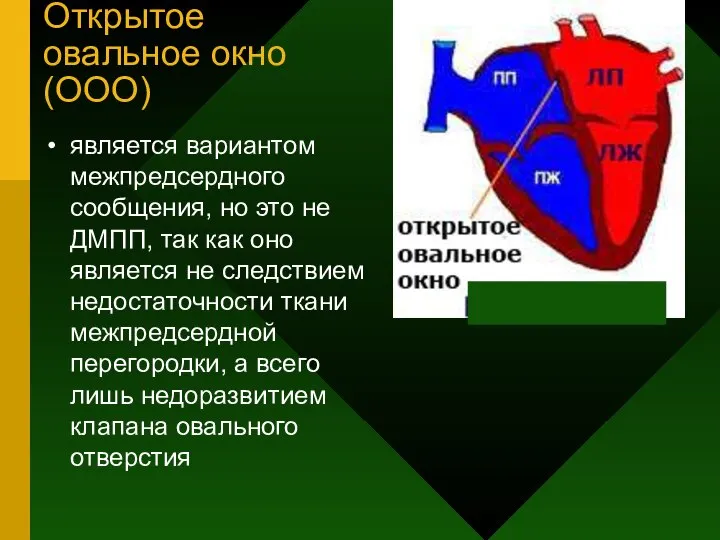 Открытое овальное окно (ООО) является вариантом межпредсердного сообщения, но это не