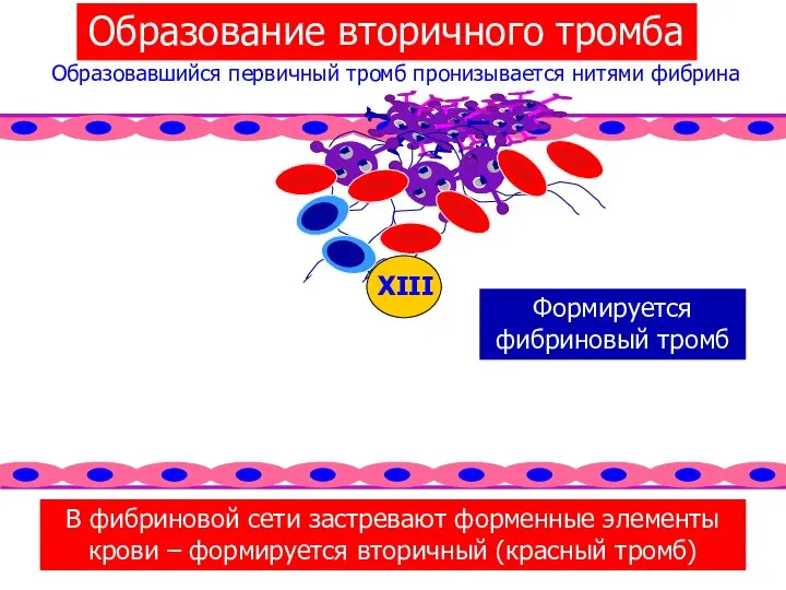 Образование вторичного тромба Образовавшийся первичный тромб пронизывается нитями фибрина В фибриновой