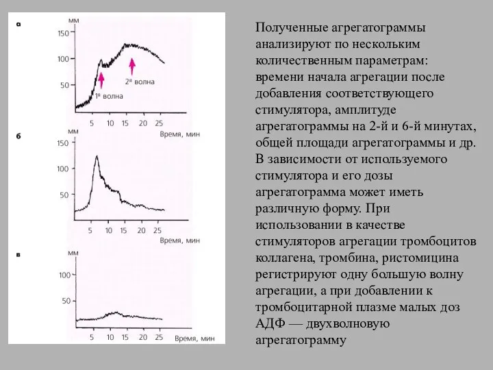 Полученные агрегатограммы анализируют по нескольким количественным параметрам: времени начала агрегации после