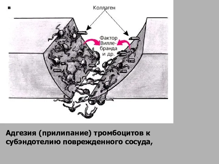 Адгезия (прилипание) тромбоцитов к субэндотелию поврежденного сосуда,