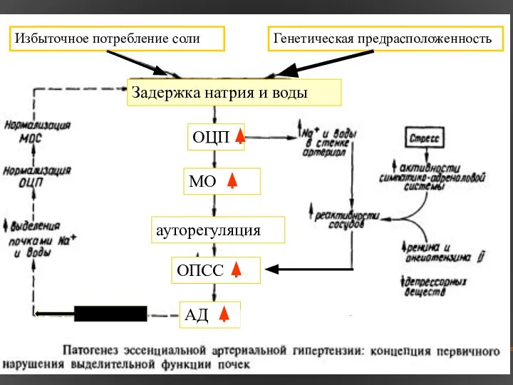 Избыточное потребление соли Генетическая предрасположенность Задержка натрия и воды ОЦП МО ауторегуляция ОПСС АД