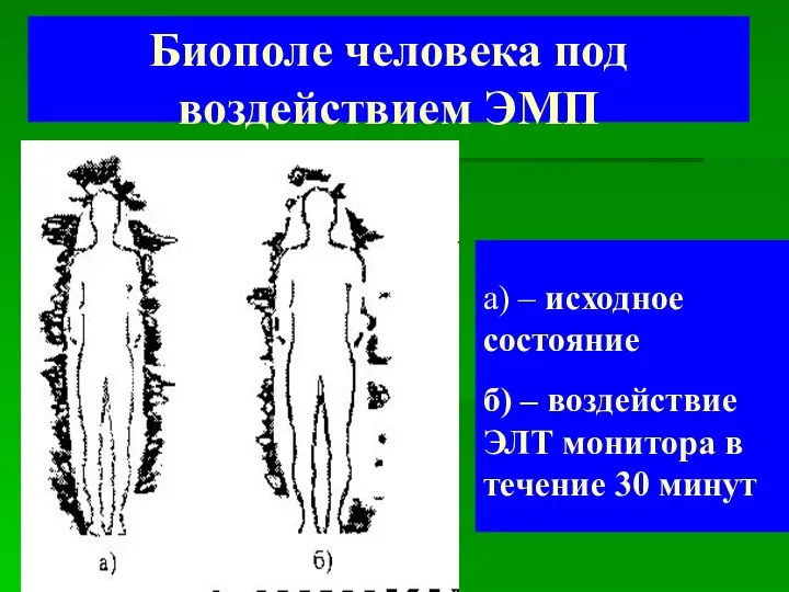 Биополе человека под воздействием ЭМП а) – исходное состояние б) –