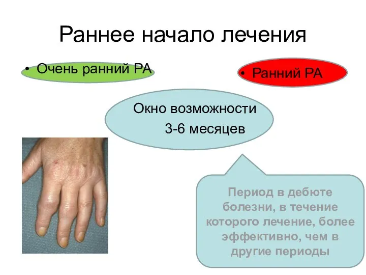 Раннее начало лечения Ранний РА Период в дебюте болезни, в течение