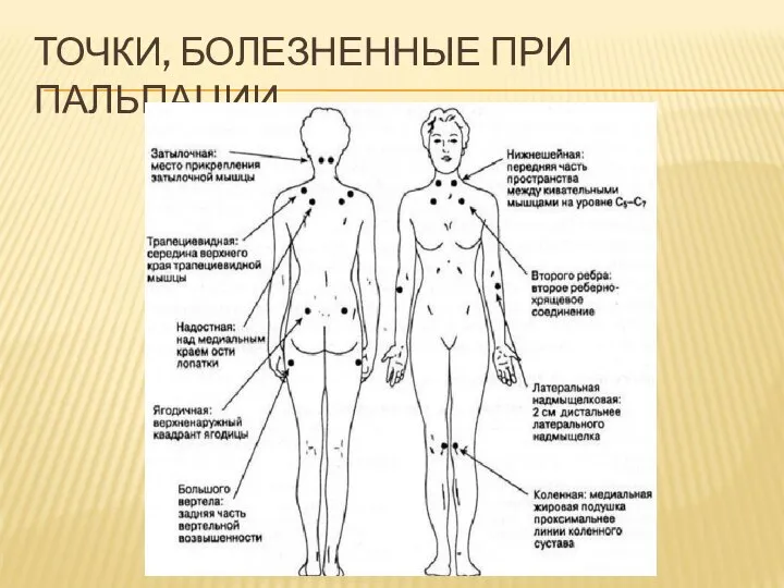 ТОЧКИ, БОЛЕЗНЕННЫЕ ПРИ ПАЛЬПАЦИИ