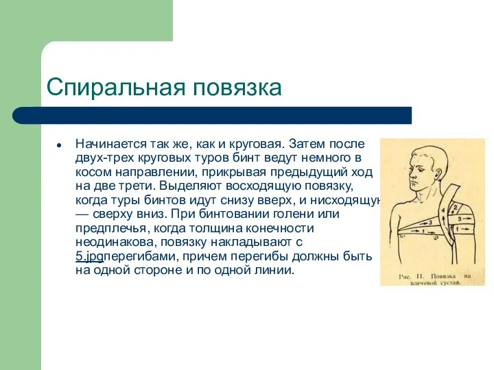 Спиральная повязка Начинается так же, как и круговая. Затем после двух-трех