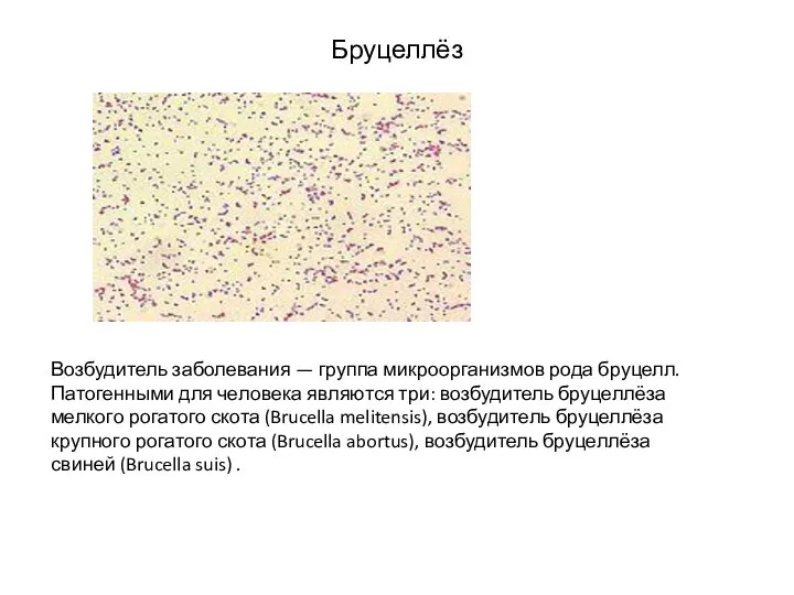 Бруцеллёз Возбудитель заболевания — группа микроорганизмов рода бруцелл. Патогенными для человека
