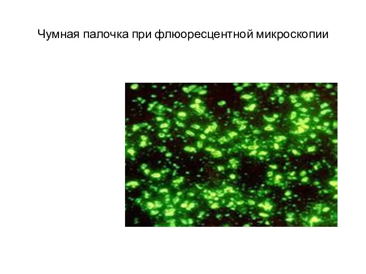 Чумная палочка при флюоресцентной микроскопии