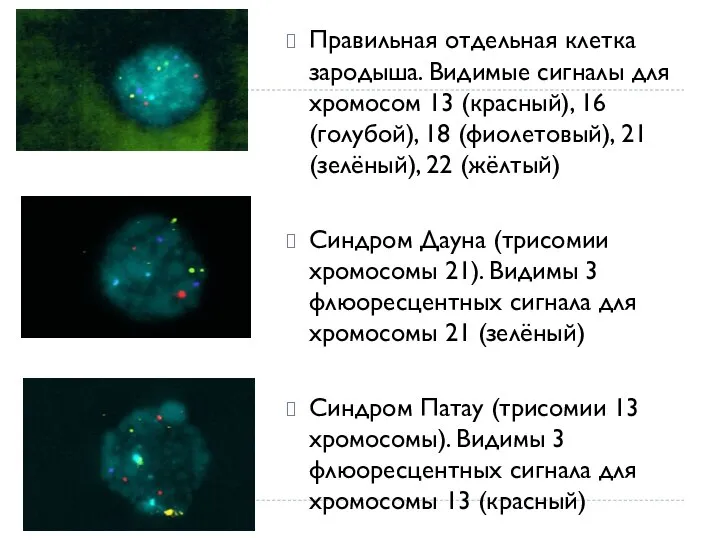 Правильная отдельная клетка зародыша. Видимые сигналы для хромосом 13 (красный), 16