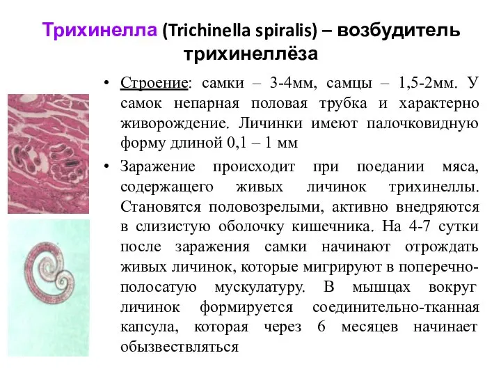 Трихинелла (Trichinella spiralis) – возбудитель трихинеллёза Строение: самки – 3-4мм, самцы