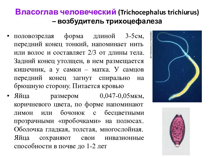 Власоглав человеческий (Trichocephalus trichiurus) – возбудитель трихоцефалеза половозрелая форма длиной 3-5см,