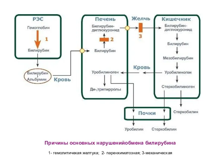 Причины основных нарушенийобмена билирубина 1- гемолитичекая желтуха; 2- паренхиматозная; 3-механическая