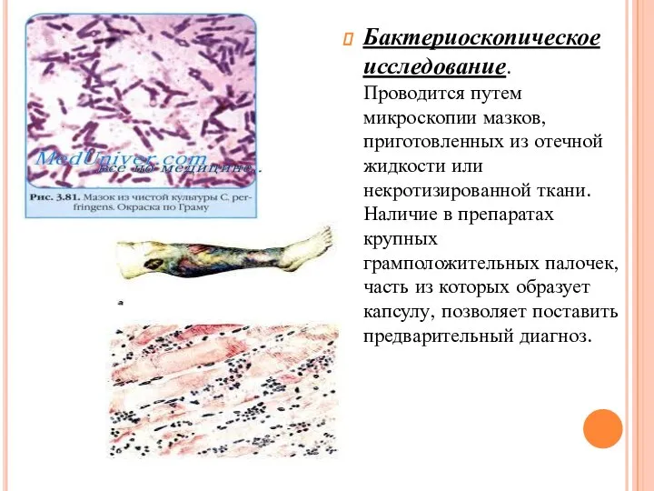 Бактериоскопическое исследование. Проводится путем микроскопии мазков, приготовленных из отечной жидкости или