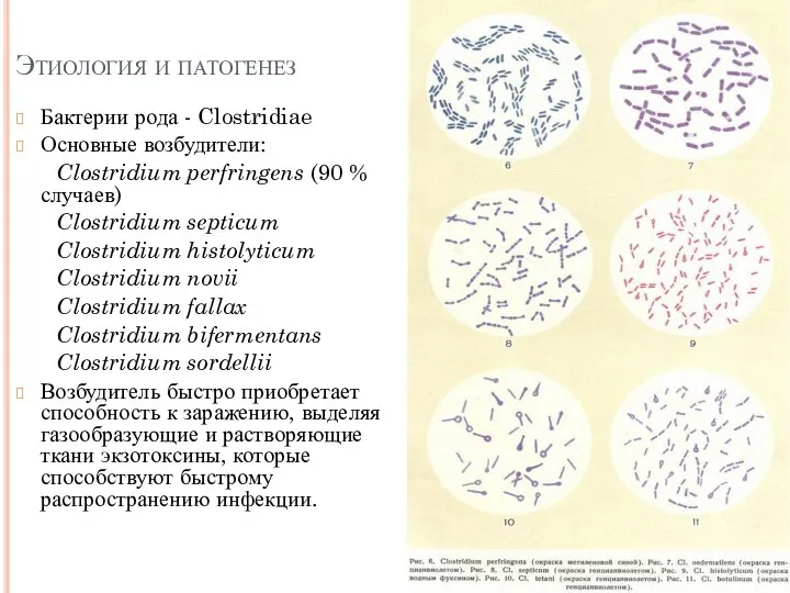 Этиология и патогенез Бактерии рода - Clostridiae Основные возбудители: Clostridium perfringens