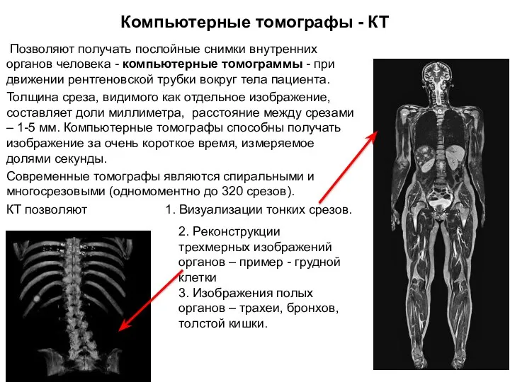 Компьютерные томографы - КТ Позволяют получать послойные снимки внутренних органов человека