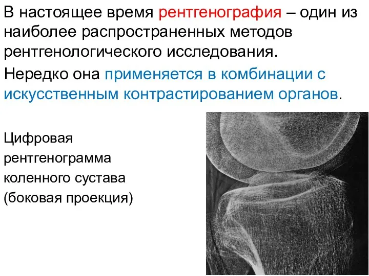 В настоящее время рентгенография – один из наиболее распространенных методов рентгенологического