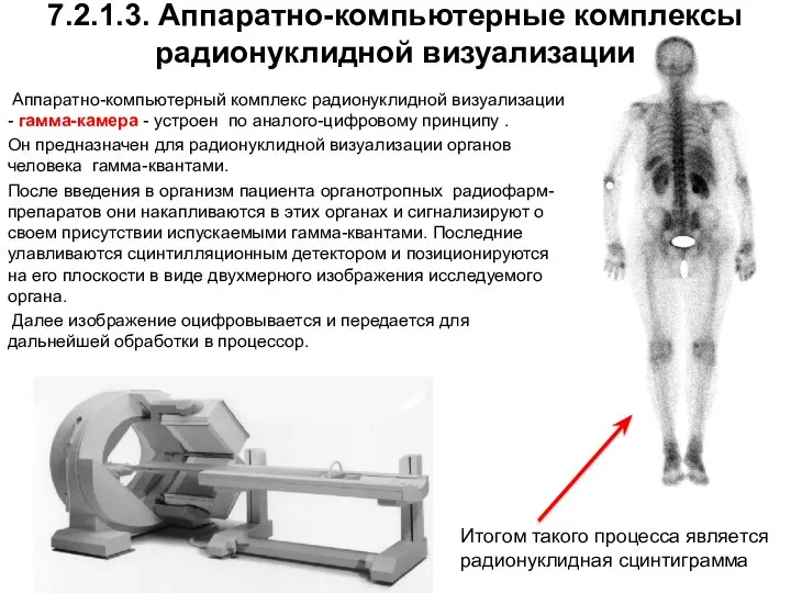 7.2.1.3. Аппаратно-компьютерные комплексы радионуклидной визуализации Аппаратно-компьютерный комплекс радионуклидной визуализации - гамма-камера