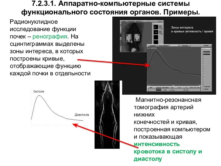 7.2.3.1. Аппаратно-компьютерные системы функционального состояния органов. Примеры. Радионуклидное исследование функции почек