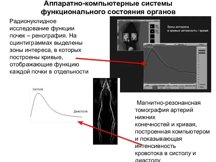 Аппаратно-компьютерные системы функционального состояния органов Радионуклидное исследование функции почек – ренография.