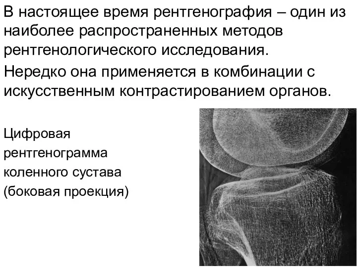 В настоящее время рентгенография – один из наиболее распространенных методов рентгенологического