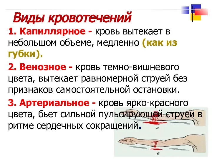 Виды кровотечений 1. Капиллярное - кровь вытекает в небольшом объеме, медленно