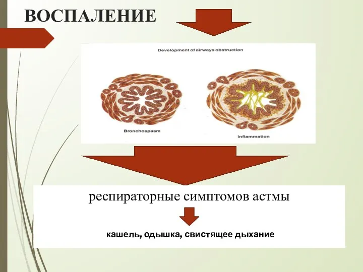 ВОСПАЛЕНИЕ респираторные симптомов астмы : кашель, одышка, свистящее дыхание