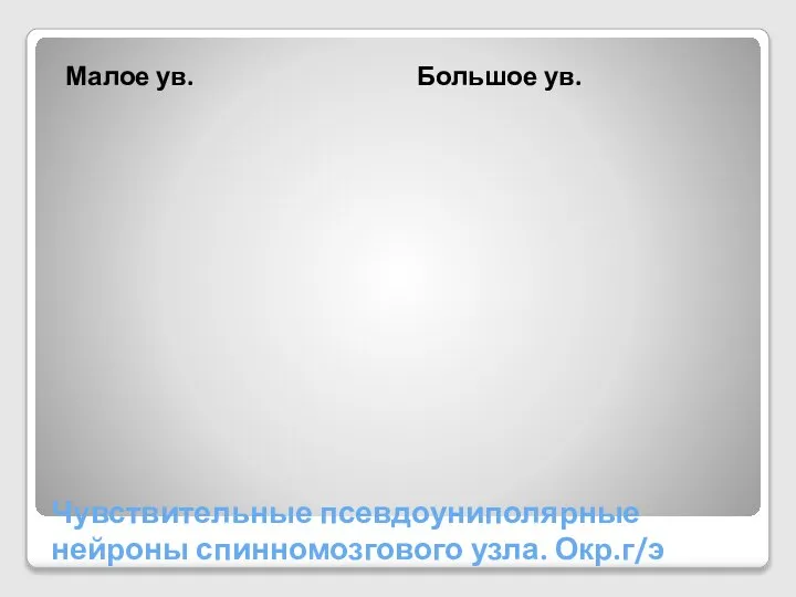 Чувствительные псевдоуниполярные нейроны спинномозгового узла. Окр.г/э Малое ув. Большое ув.