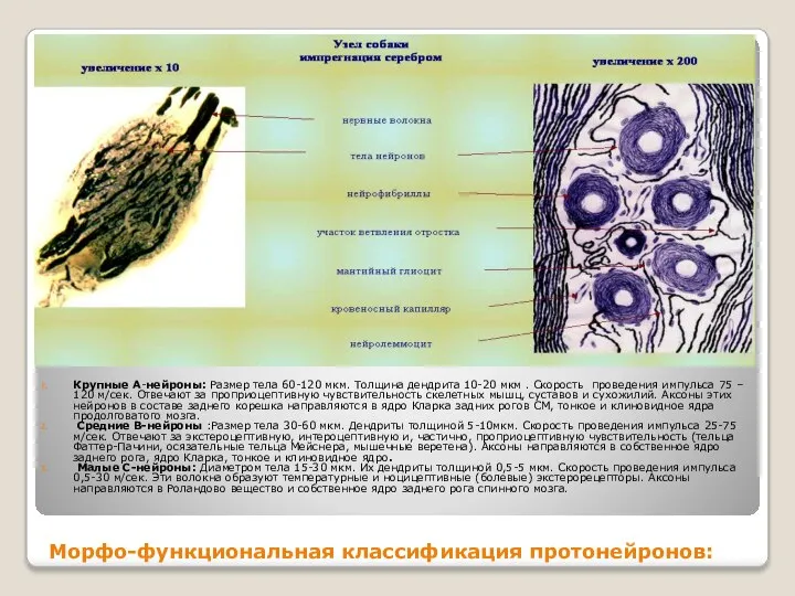 Морфо-функциональная классификация протонейронов: Крупные А-нейроны: Размер тела 60-120 мкм. Толщина дендрита