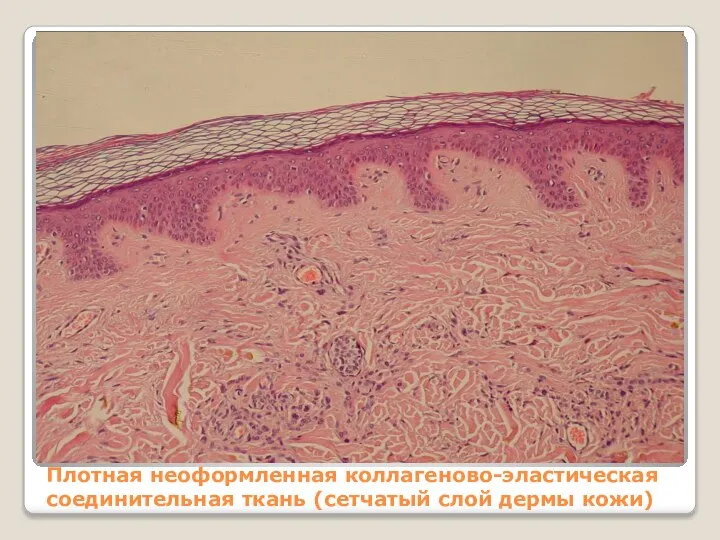 Плотная неоформленная коллагеново-эластическая соединительная ткань (сетчатый слой дермы кожи)