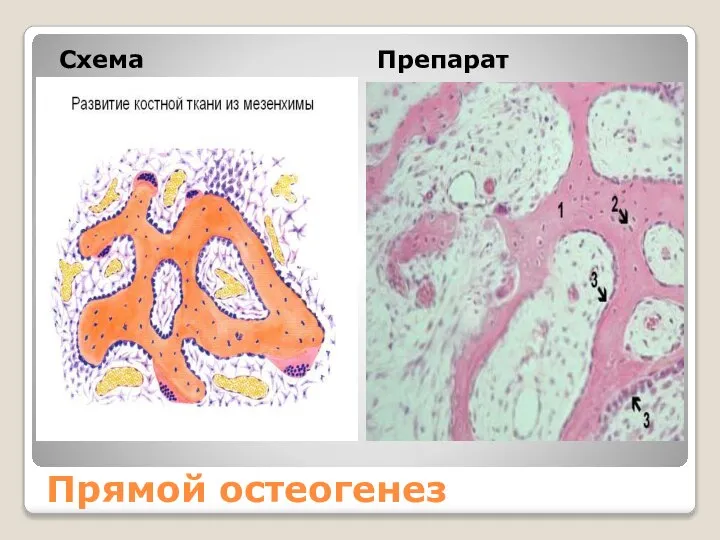 Прямой остеогенез Схема Препарат