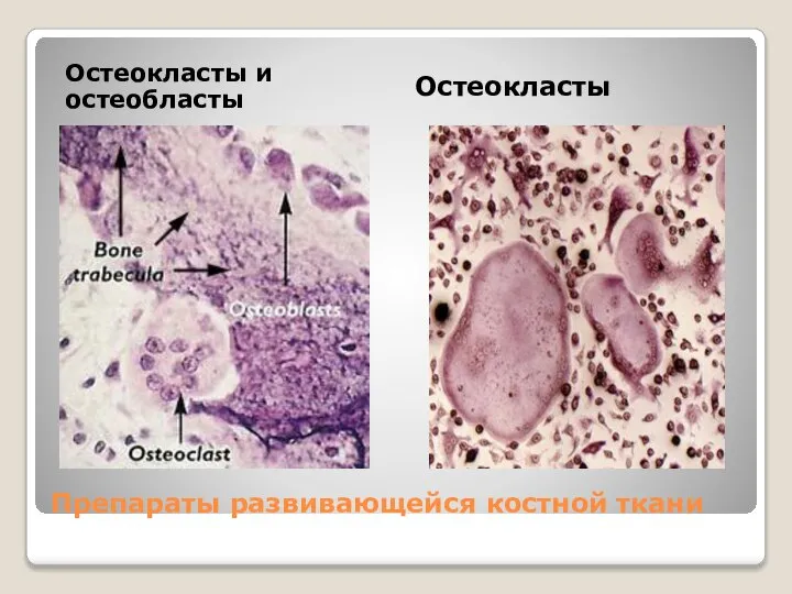 Препараты развивающейся костной ткани Остеокласты и остеобласты Остеокласты