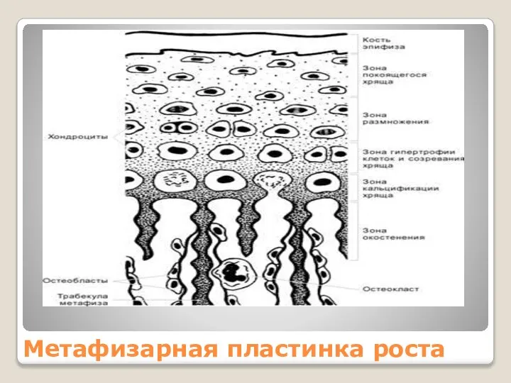 Метафизарная пластинка роста