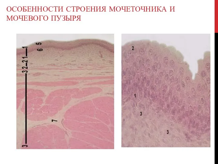 ОСОБЕННОСТИ СТРОЕНИЯ МОЧЕТОЧНИКА И МОЧЕВОГО ПУЗЫРЯ