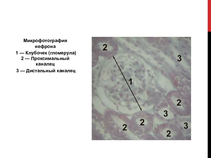 Микрофотография нефрона 1 — Клубочек (гломерула) 2 — Проксимальный каналец 3 — Дистальный каналец