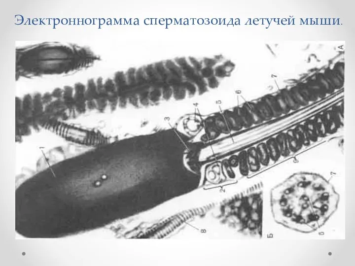 Электроннограмма сперматозоида летучей мыши.