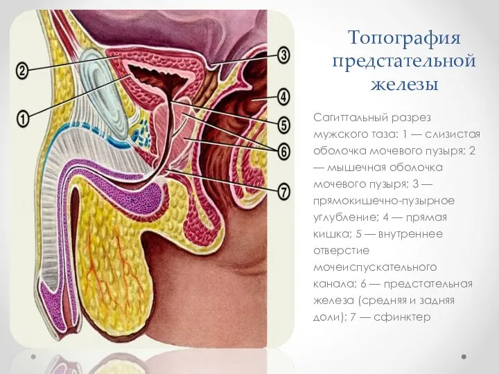 Топография предстательной железы Сагиттальный разрез мужского таза: 1 — слизистая оболочка