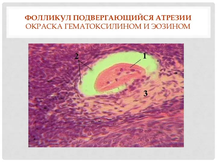 ФОЛЛИКУЛ ПОДВЕРГАЮЩИЙСЯ АТРЕЗИИ ОКРАСКА ГЕМАТОКСИЛИНОМ И ЭОЗИНОМ