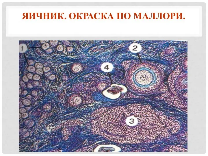 ЯИЧНИК. ОКРАСКА ПО МАЛЛОРИ.