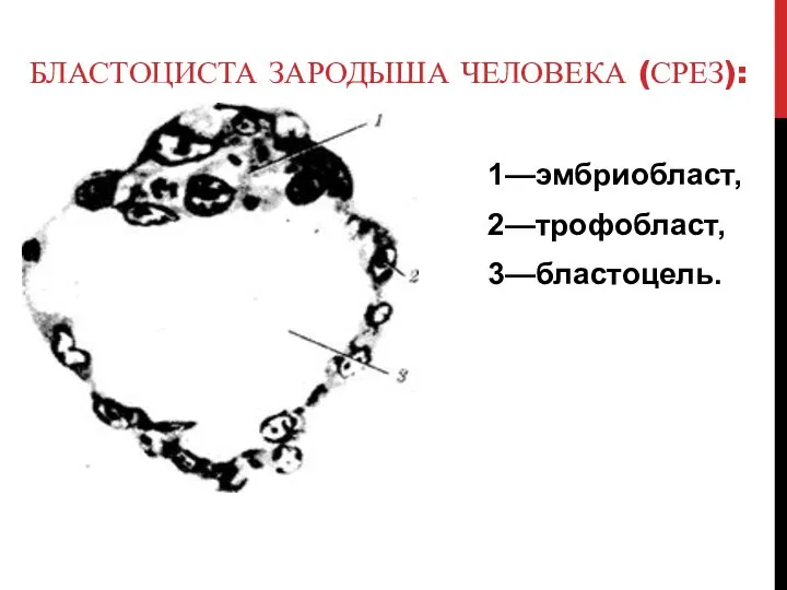 БЛАСТОЦИСТА ЗАРОДЫША ЧЕЛОВЕКА (СРЕЗ): 1—эмбриобласт, 2—трофобласт, 3—бластоцель.