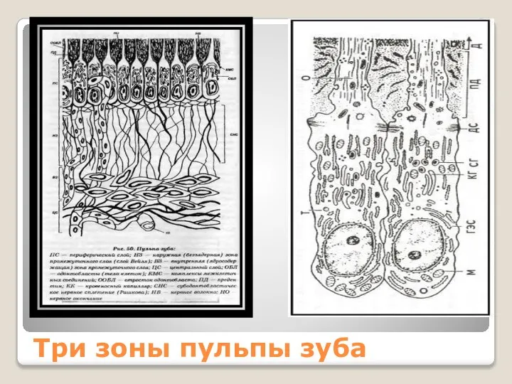 Три зоны пульпы зуба