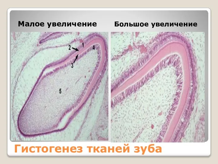 Гистогенез тканей зуба Малое увеличение Большое увеличение