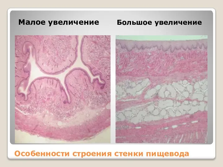 Особенности строения стенки пищевода Малое увеличение Большое увеличение