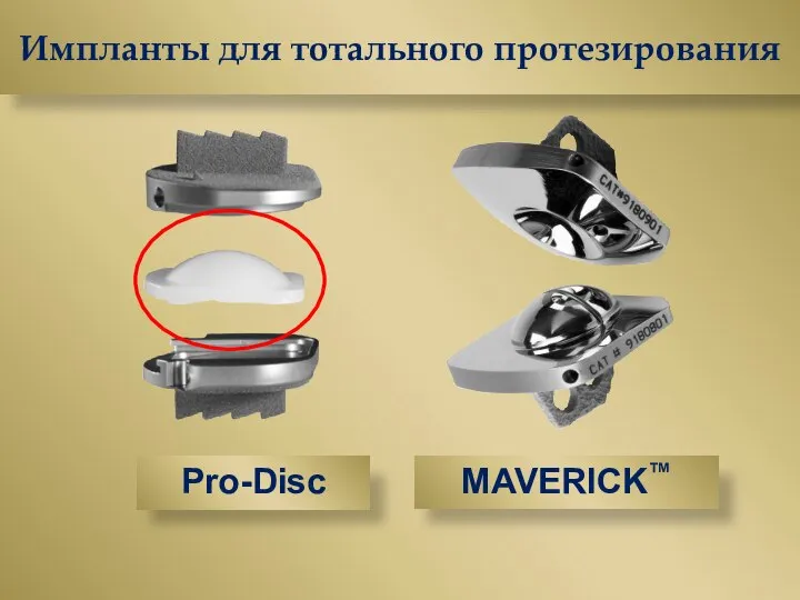 Pro-Disc MAVERICK™ Импланты для тотального протезирования