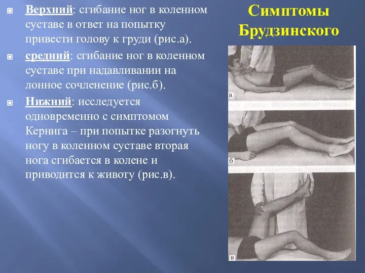 Симптомы Брудзинского Верхний: сгибание ног в коленном суставе в ответ на