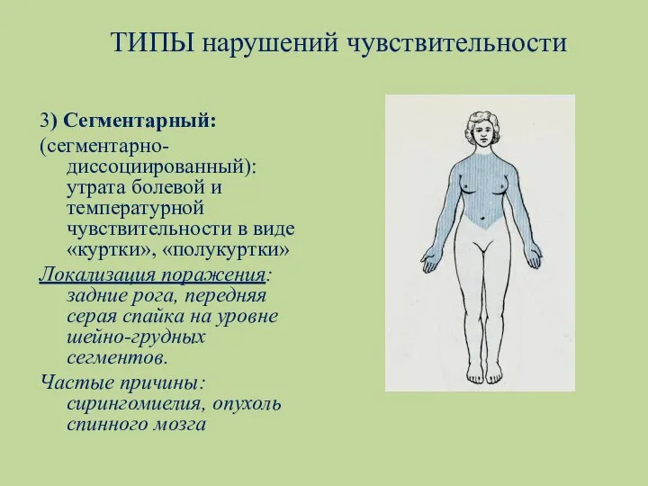 ТИПЫ нарушений чувствительности 3) Сегментарный: (сегментарно-диссоциированный): утрата болевой и температурной чувствительности