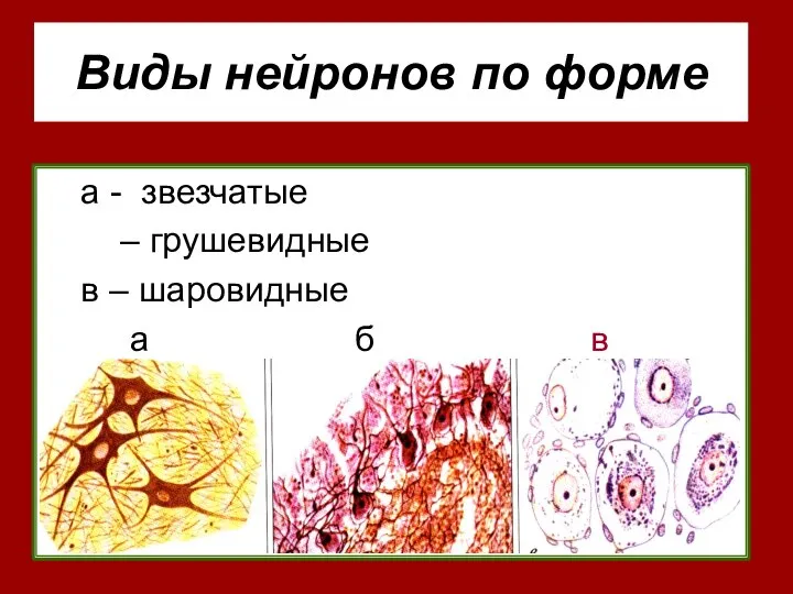 Виды нейронов по форме а - звезчатые – грушевидные в – шаровидные а б в