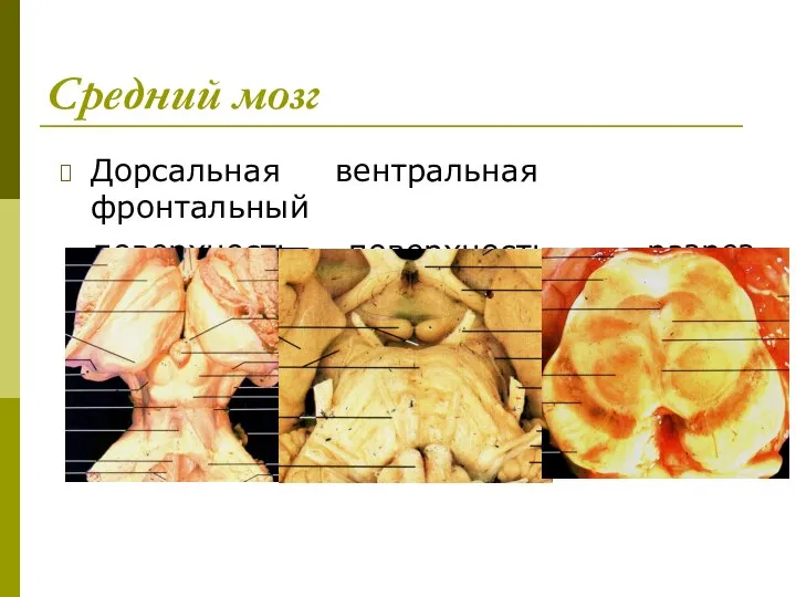 Средний мозг Дорсальная вентральная фронтальный поверхность поверхность разрез