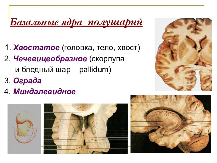 Базальные ядра полушарий 1. Хвостатое (головка, тело, хвост) 2. Чечевицеобразное (скорлупа