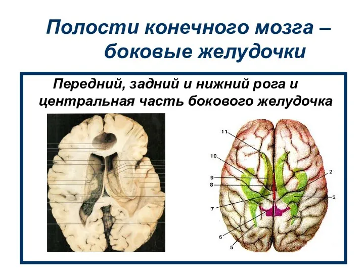 Полости конечного мозга – боковые желудочки Передний, задний и нижний рога и центральная часть бокового желудочка