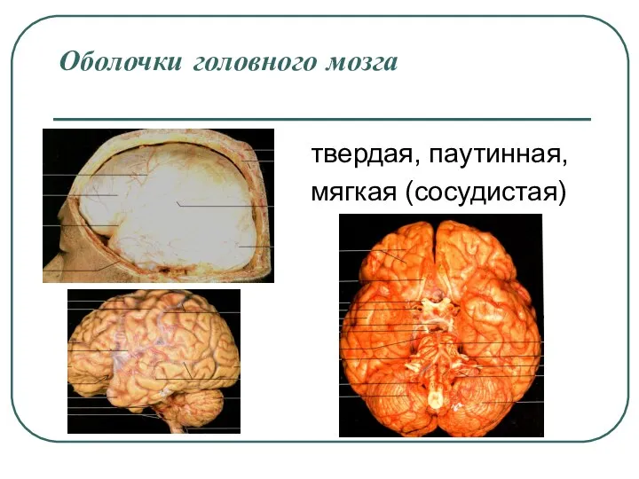 Оболочки головного мозга твердая, паутинная, мягкая (сосудистая)