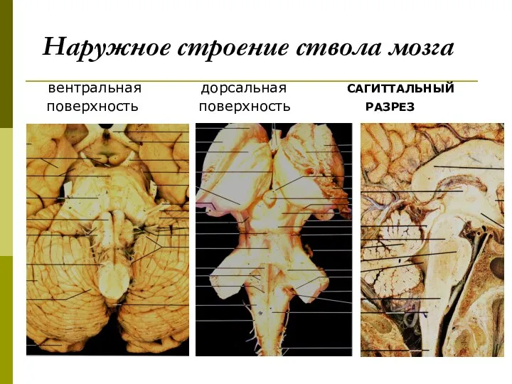 Наружное строение ствола мозга вентральная дорсальная САГИТТАЛЬНЫЙ поверхность поверхность РАЗРЕЗ